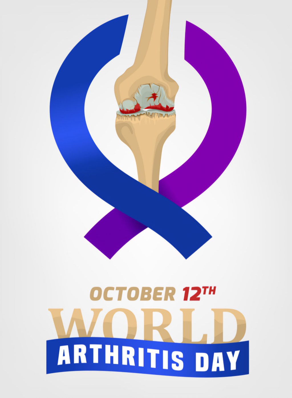 જી. કે. જન. હોસ્પિ.ના ઓર્થો તબીબોએ વિશ્વ આર્થરાઇટિસ ડે નિમિતે સાંધાના  દુખાવા સામે આપ્યું&nbsp;માર્ગદર્શન